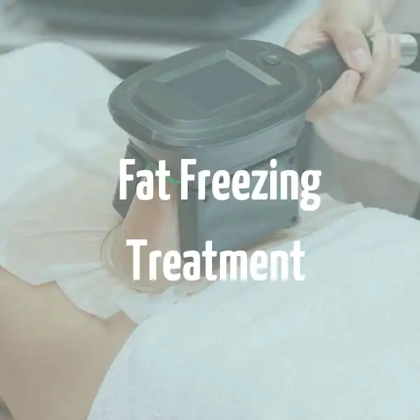 fat freezing treatment St Albans