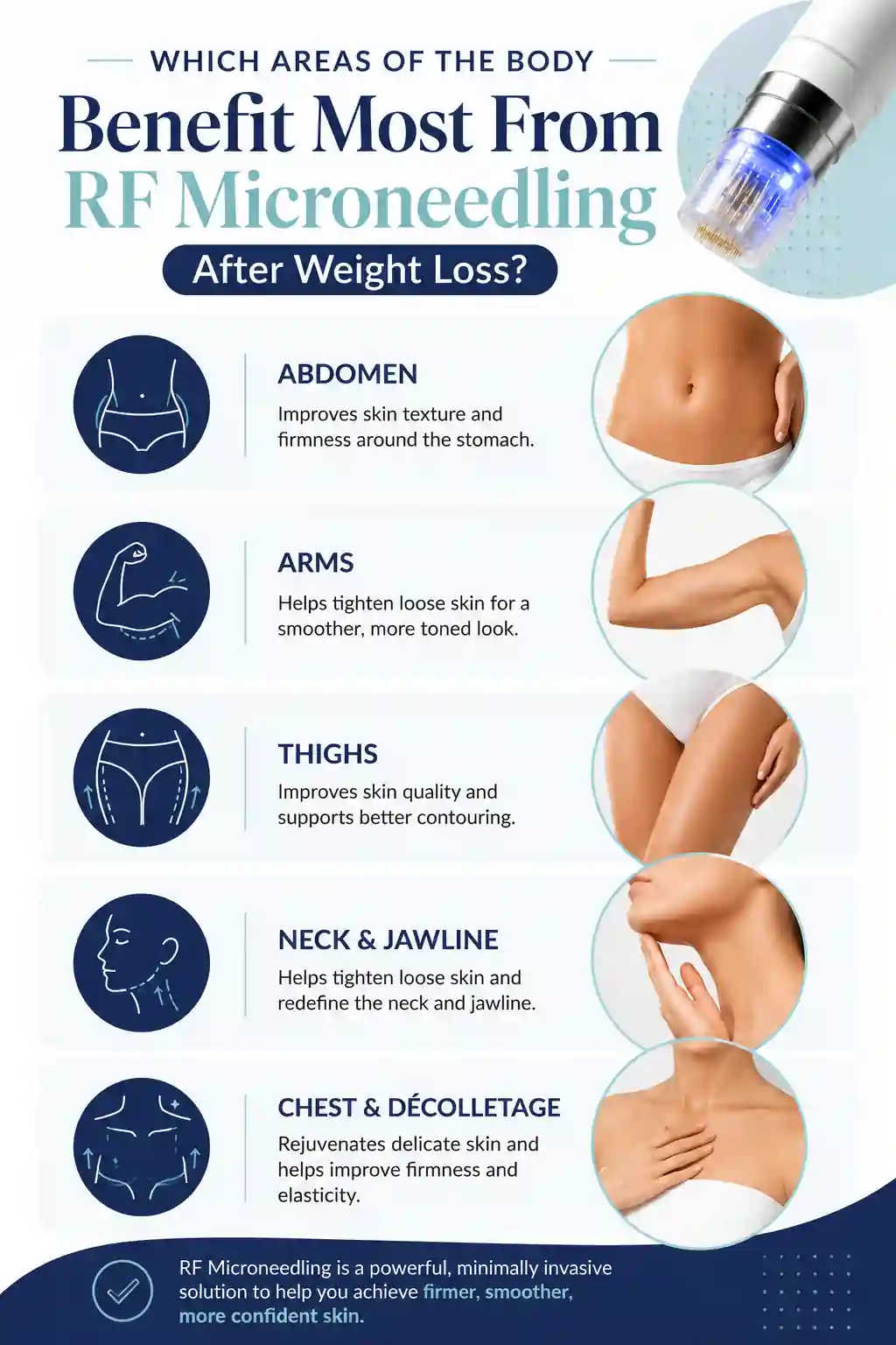 Which Areas of the Body Benefit Most From RF Microneedling After Weight Loss St Albans