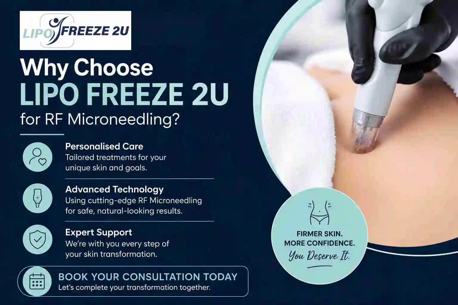 Why Choose LIPO FREEZE 2U for RF Microneedling St Albans?